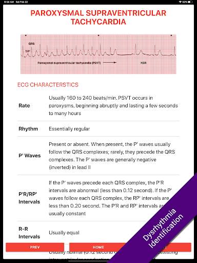ECG FlashCards 2 Lite - Free Reference EKG App screenshot 2