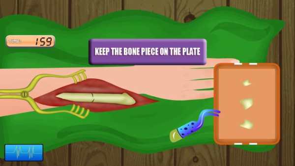 Operating Arm Game screenshot 4