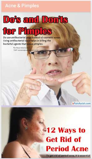 Acne & Pimples screenshot 1
