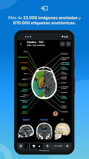 e-Anatomy screenshot 2
