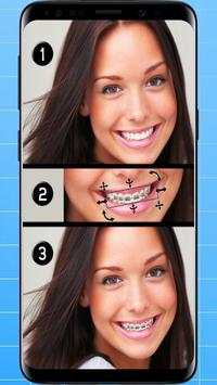 Braces Photo Editor screenshot 1