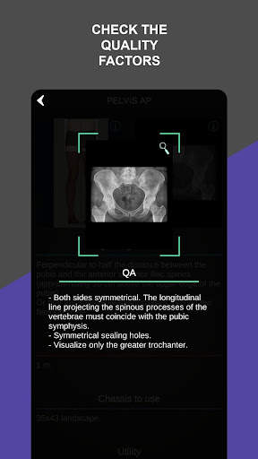 RX - Radiographic Positioning screenshot 6