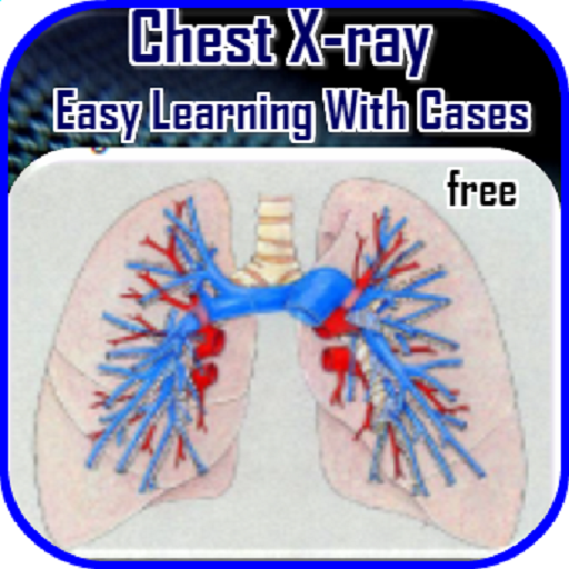 Chest X-ray Easy Learning icon