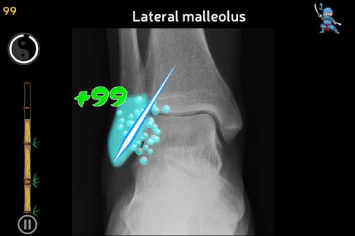 Anatomy Ninja Lower Limb screenshot 4