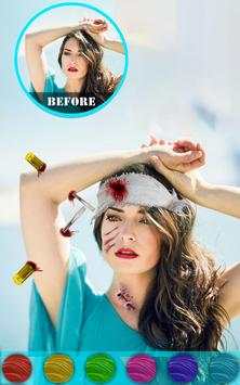Injury Photo Editor скриншот 7