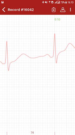 Dr ECGo screenshot 6