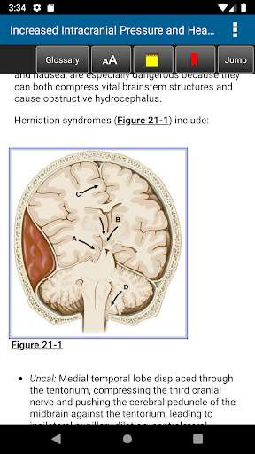 Harrison's Manual of Medicine 20th Edition screenshot 5