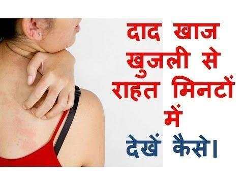 खुजली के इलाज Khujli Ke Ilaj Khujli Ke Upay screenshot 1