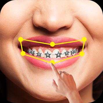 Braces Pro screenshot 1