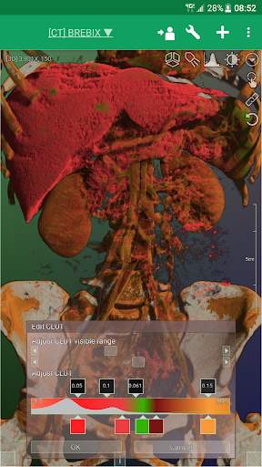 DroidRender - 3D DICOM viewer स्क्रीनशॉट 8