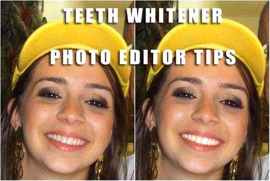 Teeth Whitener Photo Edit Tips screenshot 1