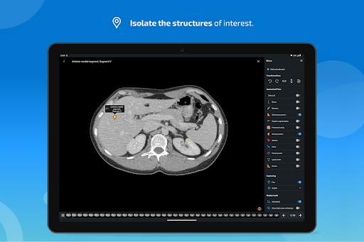 e-Anatomy screenshot 12