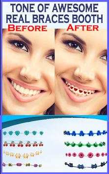 Braces Teeth Photo Maker screenshot 2