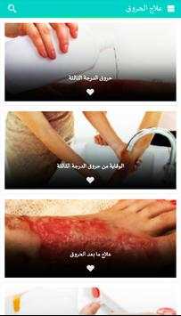 علاج الحروق 1 تصوير الشاشة