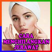 Cara Menghilangkan Jerawat Terbaru