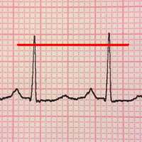 ECG Reader free
