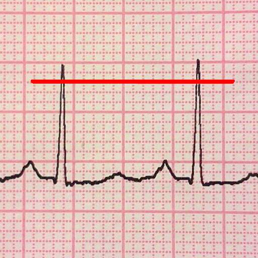 ECG Reader free 4.1