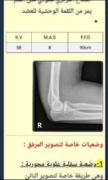 xray скриншот 5