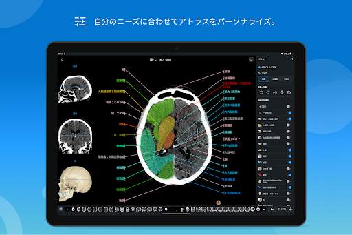 e-Anatomy screenshot 14