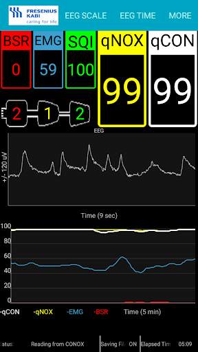 Conox View screenshot 2