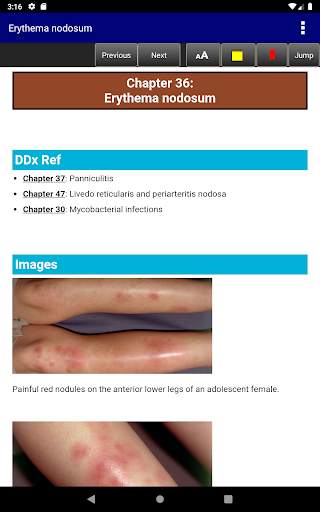 Pediatric Dermatology DDx Deck, 2nd Edition screenshot 12