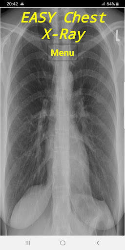 Easy Chest X-Ray скриншот 1