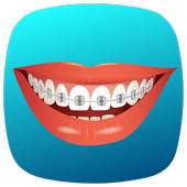 Braces Camera B612 1.0