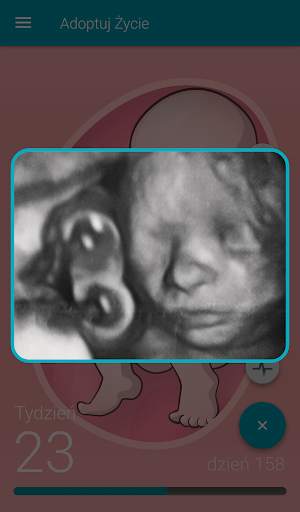 Adopt a Life screenshot 3