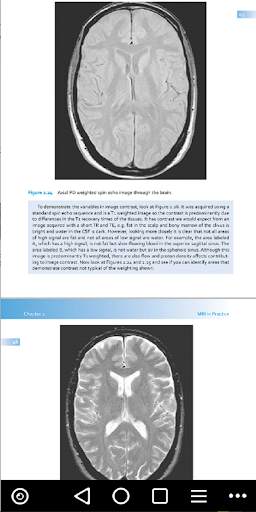 MRI - Regional Anatomy of the Brain Using MRI screenshot 6
