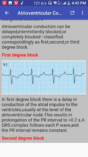 Clinical ECG Guide. screenshot 2