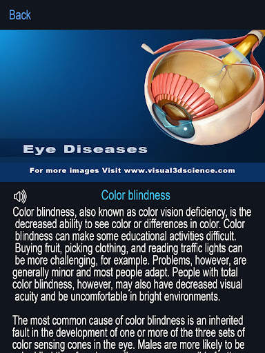 My Eye Anatomy screenshot 8