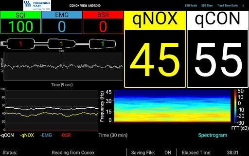 Conox View screenshot 14