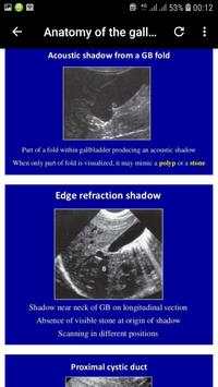 abdominal ultrasound of gallbladder скриншот 5