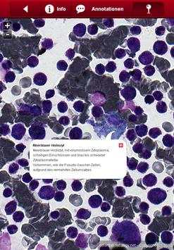 Smart Hematology Lite screenshot 4