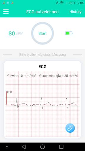 SnapECG screenshot 2