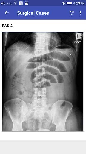 Explained Clinical Case Scenarios With Answers screenshot 5