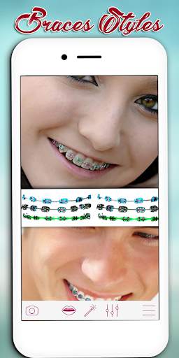 Braces Photo Editor screenshot 6