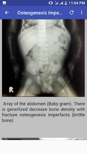 Bone X Ray Interpretation (Musculoskeletal X ray) screenshot 2