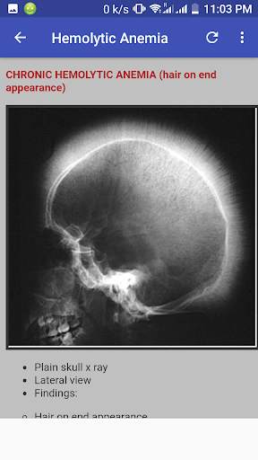 Bone X Ray Interpretation (Musculoskeletal X ray) screenshot 5