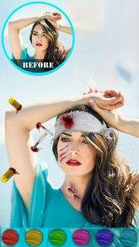 Injury Photo Editor скриншот 12