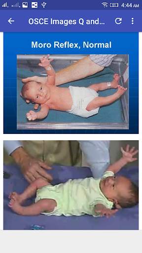 Pediatrics  OSCE Q and A screenshot 8