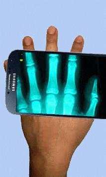 Xray Scanner screenshot 6