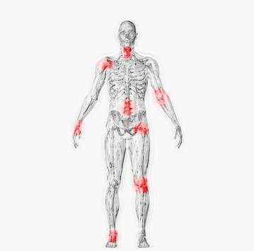Arthritis Rehab screenshot 1