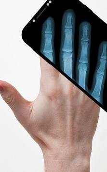 Xray Scanner screenshot 3