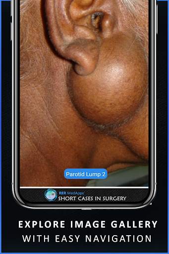 Short Cases in Surgery - OSCE for Medical Doctors screenshot 6