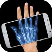 Xray Cam Real 3.1