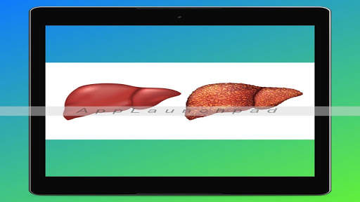 Hepatitis B Interactive screenshot 1
