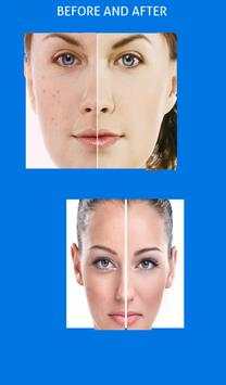 Face Beauty App- Makeup Camera screenshot 1