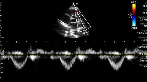 Philips Lumify Ultrasound App screenshot 7