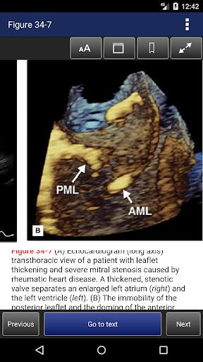Cardiac Surgery in the Adult, 5th Edition screenshot 8